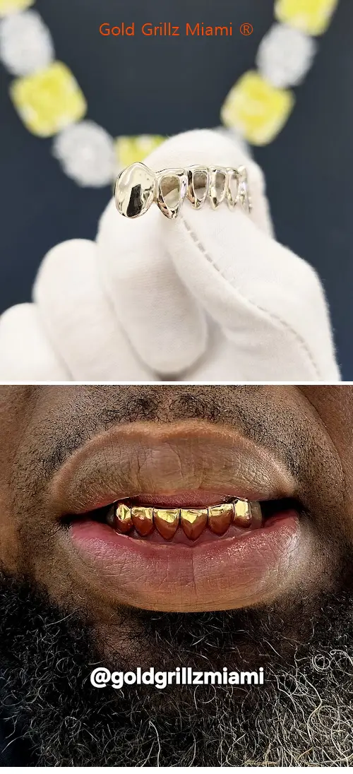 gold grillz miami ® fl