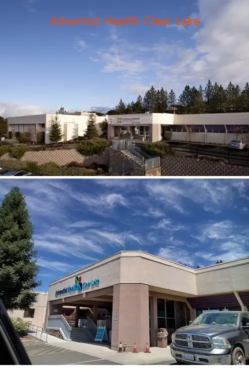 adventist health clear lake ca